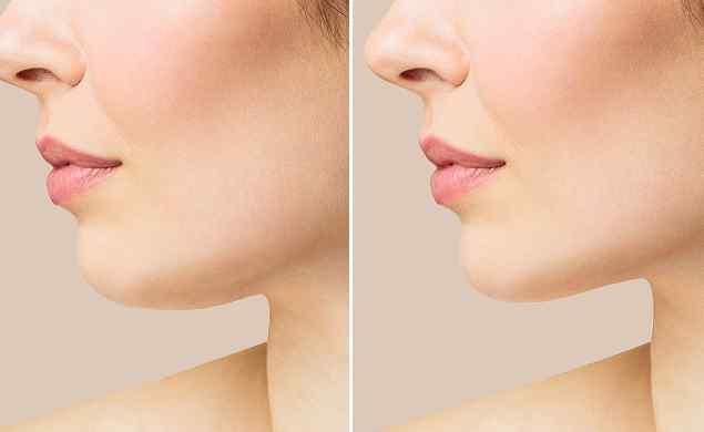 https://ascenciaservices.com/wp-content/uploads/2026/05/image_before_after_02.jpg