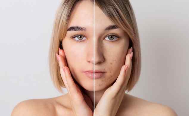 https://ascenciaservices.com/wp-content/uploads/2026/05/image_before_after_04.jpg